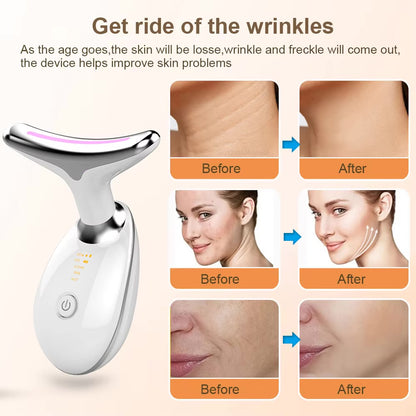 EMS Face & Neck Lifting Device – Tighten, Sculpt & Rejuvenate for a Youthful Contour