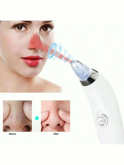 Pore Cleansing Beauty Tool – Remove Blackheads & Unclog Pores Instantly